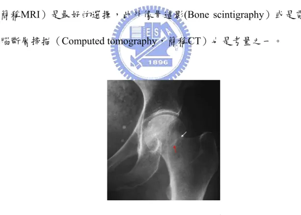 圖 2.3、在 X 光片下難以發現其變化 