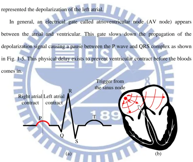 Fig. 1-4 The trigger from sinus node signals atrial to contraction result in P wave. 