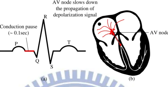 Fig. 1-5 The AV node slows down the depolarization signal result in a small pause between the  contraction of atrial and ventricular