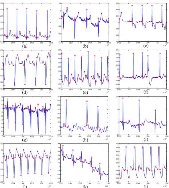 Fig. 2-9 shows the detection result of the proposed algorithm with different  wave  morphologies and noise coupling