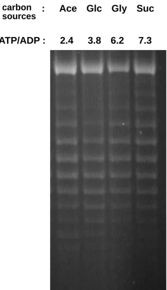 Fig 2. Effect of carbon source on DNA superocoiling of E. coli in batch  culture. Chloroquin-agarose gel electrophoresis showing differences in DNA  supercoiling of pBR322 from strains grown in different carbon sources
