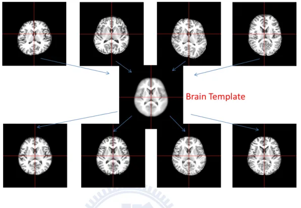 Figure 1.1: Usage of template image. To compare the different MRI images from scanning machine, template image provides a common space of structural coordinate system.