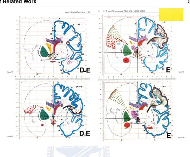 Figure 1.2: Talairach atlas. Talairach atlas of the human brain was introduced in 1988 by Talairach and Tournoux