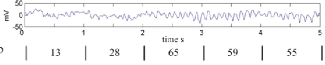 Figure 3    Alpha detection: the session with  ρ >= 50% is defined as alpha dominated
