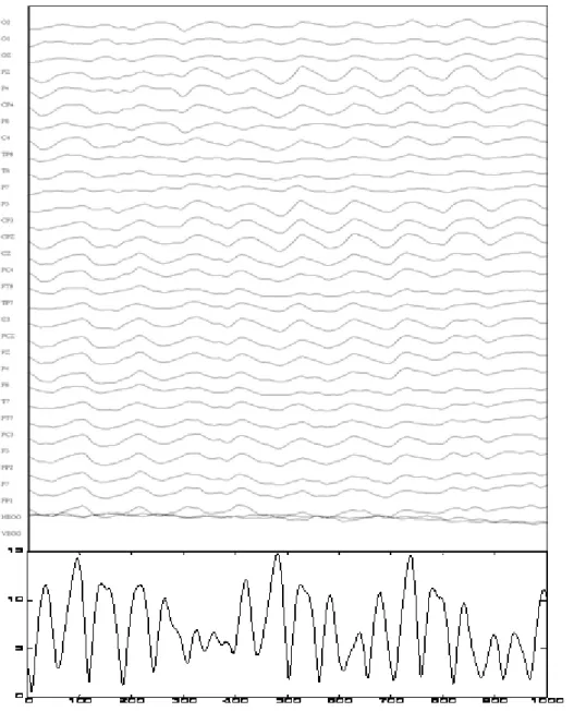 Figure 5    The GFP of 1 second EEG epoch. 
