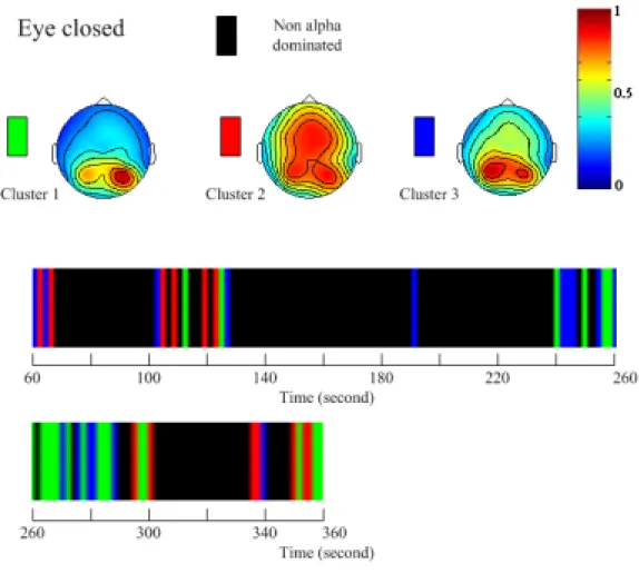 Figure 6    Results of interpretation and classification of EEG brain mappings for a control subject in the  pre-session background recording (before main session of relaxation)