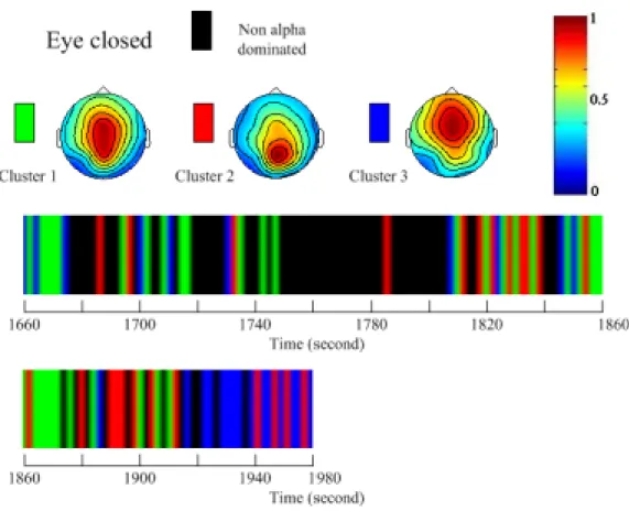 Figure 9    Results of interpretation and classification of EEG brain mappings for an experimental subject in the  pre-session background recording (before main session of meditation)