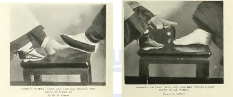 Figure 3. Comparison between bind and unbind feet. The photos are from Intimate China