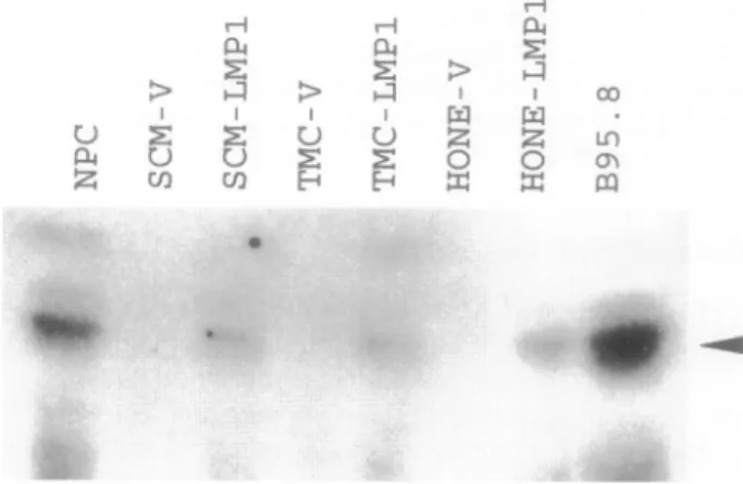 Figure 1. Western blot assay for LMP1 expression in pMAM-LMP1-transfected gastric carcinoma and NPC cells