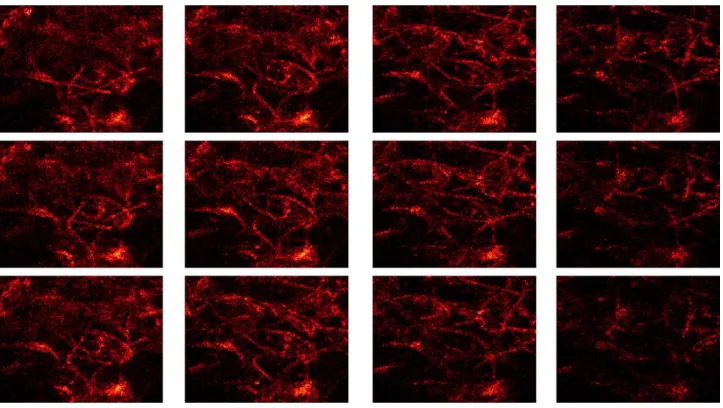Fig. 6. Sequential sections of CLSM images of the flocculated floc (left-up to right-down) at 1.5-µm interval (160 ppm polyelectrolyte).