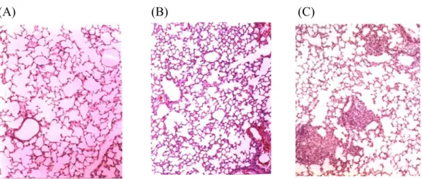 Fig. 2. Granuloma formation in lungs after Histoplasma infection. Lung tissue was  collected from normal mouse (A), mouse inoculated intratracheally with heat-killed  Histoplasma yeast cells (B) and live yeast cells (C)
