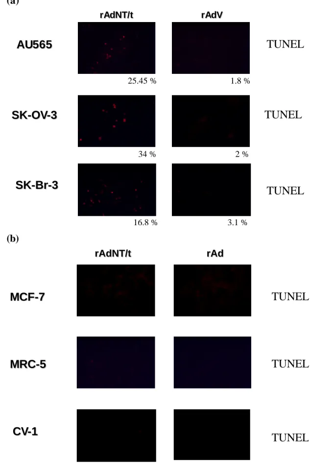Fig. 6  TUNEL assay showed that T/t-common-containing adenovirus infection  induced apoptosis in HER-2/neu-overexpressing cancer cells (a) but not in HER-2/neu  low-expressing cancer cells and non-transformed cells (b) 