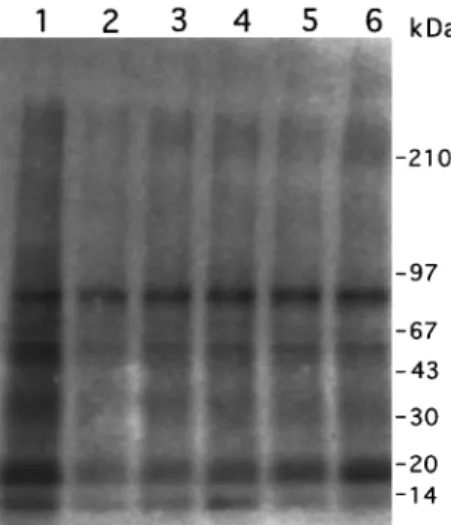 Figure 4 Eect of luteolin (Lu) and EGF on the tyrosine kinase activity of A431 cellular proteins