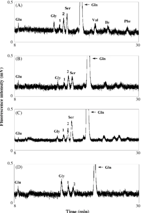 Fig. 2. Separations of amino acid derivatives in different CSF samples in the absence of EOF using 0.6% PEO(0.6) prepared in 10 mM tetraborate (pH 9.3)