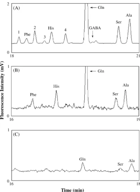 Fig. 4. Separations of amino acid derivatives in different CSF samples in the presence of EOF using 2.0% PEO(8.0)