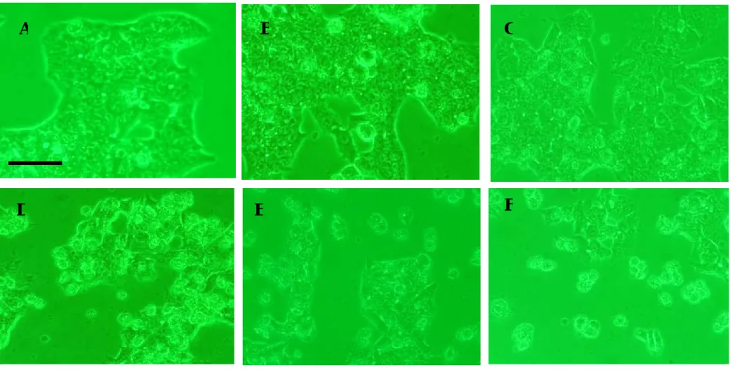 Figure 7. Effects of various concentrations of EFMA from our lab on the morphology of Hep G2 cells (200X under inverted stage microscope  equipped with phase contrast)