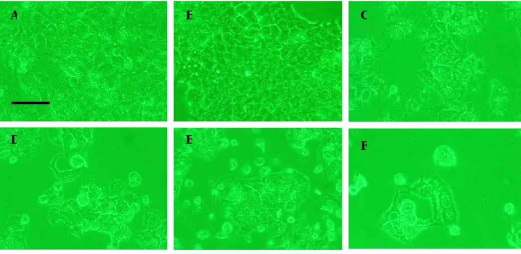Figure 8. Effects of various concentrations of EFMA from our lab on the morphology of Hep 3B cells (200X under inverted stage microscope  equipped with phase contrast)