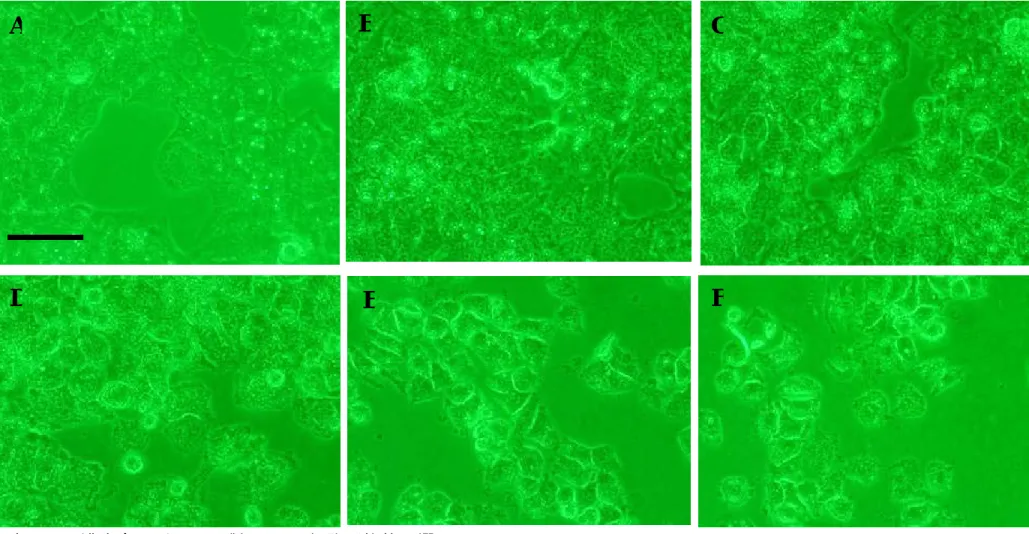 Figure 6. Effects of various concentrations of FFMA from FIRDI on the morphology of Hep 3B cells (200X under inverted stage microscope  equipped with phase contrast)