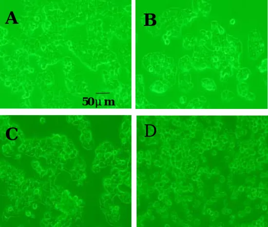 Fig. 5. Effect of various concentrations of ginger oil on the morphology of   hepatoma cell line Hep 3B after 24 hrs treatment