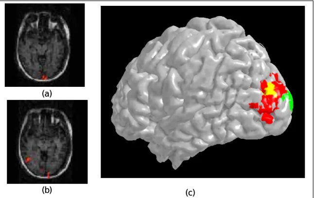 Figure 12. (a) &amp; (b) psudo-color patches show the areas with differential activation in  the dipole summation