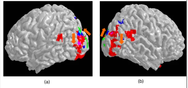 Figure 13. Summary of the three experiments. The green patches denote the  voxels showing differential activation between the Glass pattern and the texture  patterns