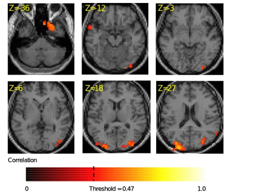 Figure 4. Brain activation map for Glass patterns. The pseudo-color  denotes the correlation level