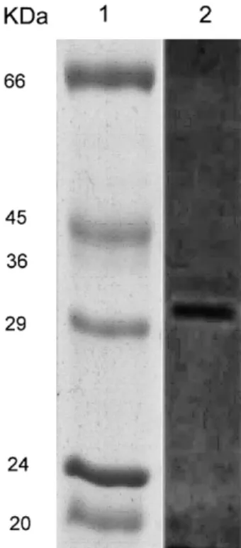 Fig. 1. Zymogram analysis of E. coli lysate using xylan substrate and Congo-red staining