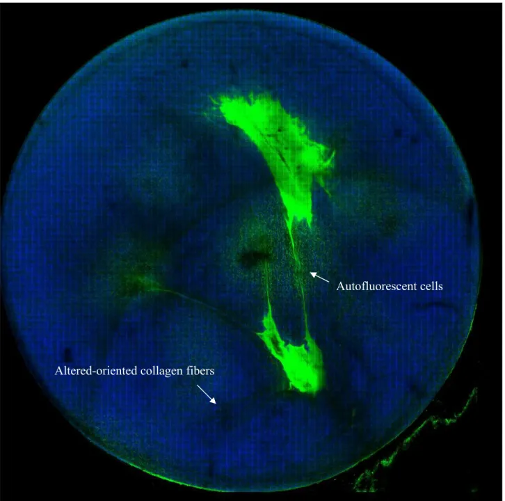 Fig. 1. The multiphoton autofluorescence and SHG imaging of the whole keratoconic corneal specimen