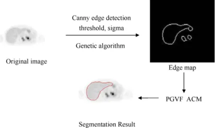 Fig. 1. The flow chart of the automatic segmentation method of liver PET images.