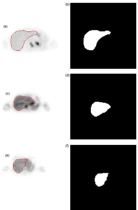 Fig. 9. The shape and location of contours (a), (c), and (e) and binary regions (b), (d), and (f) of images D1(9), D2(9), and D3(9).