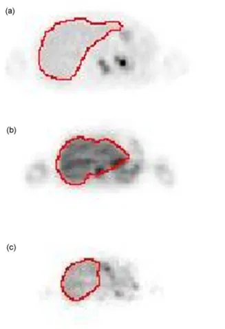 Fig. 11. The shape and location of the initial curve (a) obtained from result of the 9th slice and progressing results at (b) 40th and (c) 100th iterations.