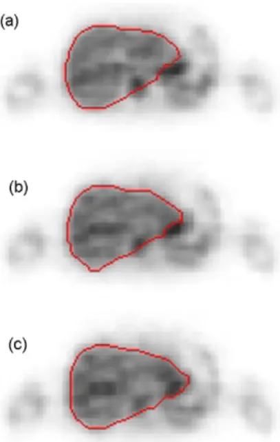 Fig. 14. The segmentation results of (a) 8th, (b) 10th, and (c) 11th slice of D2.
