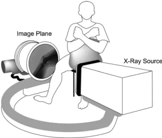 Fig. 1. Schematic diagram showing a subject performing active knee exten- exten-sion under dynamic fluoroscopic surveillance