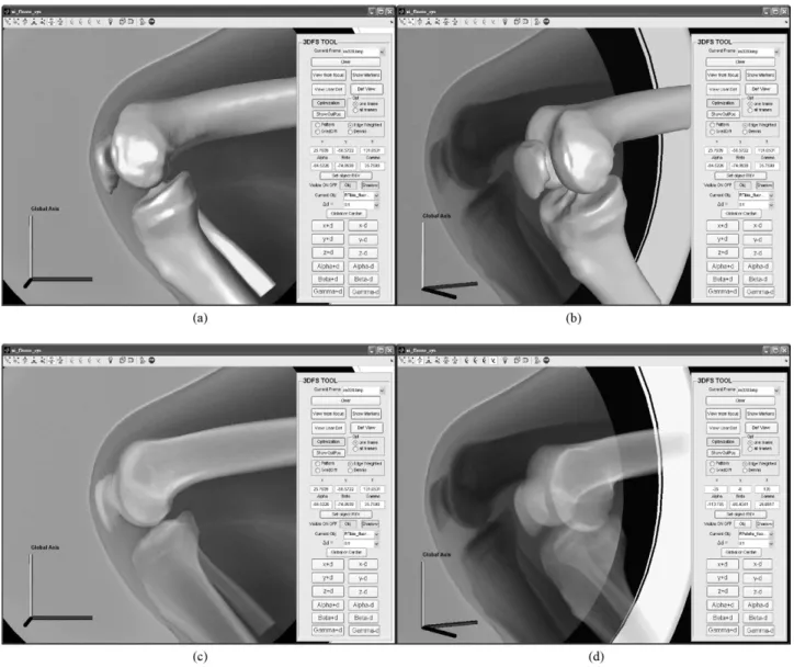 Fig. 2. The computer graphics user interface (GUI) program to assist the visualization of the registration and reconstruction of the 3D bone kinematics