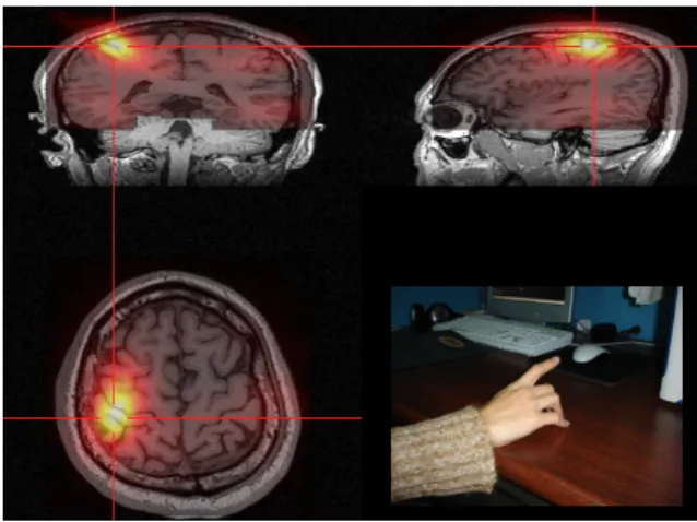 Figure 1.1: A finger lifting example about brain functional mapping. When we perform a certain functional task, the corresponding cortex areas in the brain will activate