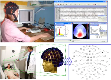 Figure 1.3: Acquisition of the electric and induced magnetic signals by EEG and MEG.