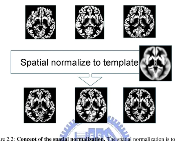 Figure 2.2: Concept of the spatial normalization. The spatial normalization is to correct the differences of shape and size between each subjects