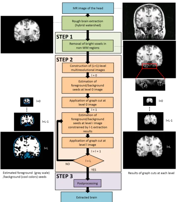 Fig. 2. Flowchart of the proposed brain extraction method.