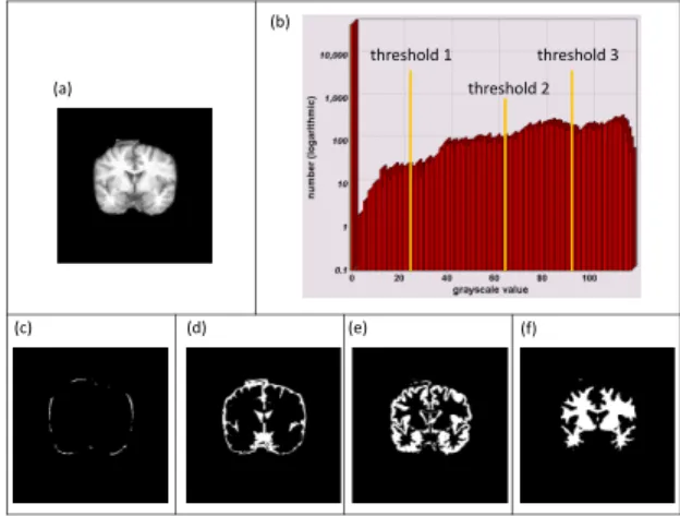 Fig. 5. The results of segmented white matter tissue in coronal slice. Top row are the results of the initial brain extraction