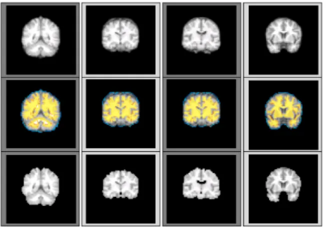 Fig. 8. Demonstration of foreground seeds, background seeds and results at the lowest resolution level