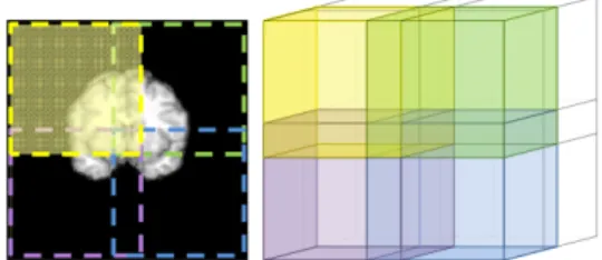 Fig. 12. The red circle is the dark volume may be classified as background that need to be post-processed
