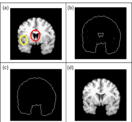 Fig. 13. (a) The red circle is the dark voxels in brain but be classified as background, and yellow circle is the voxels deleted in step1of flowchart but belong to brain region, that both need to be post-processed