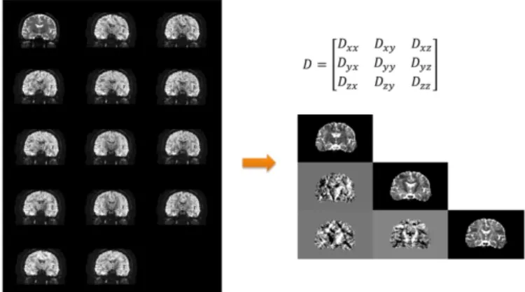 Figure 1: One slice of Diffusion tensor image (right) generated by  diffusion-weighted images (left) 