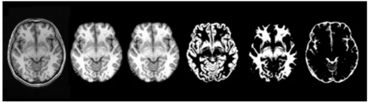 Figure 2: Template images created from 1992 to 2009 at Montreal    Neurological Institute