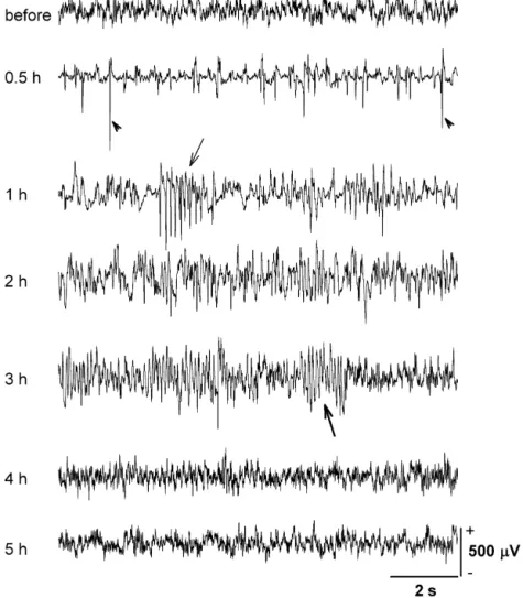 Fig. 1. A representative example of the EEG change in one rat before and after PB administration (50 mg / kg, i.p.)