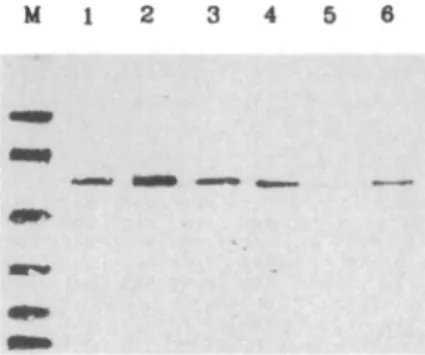 Figure 4 shows sodium dodecyl sulfate (SDS)-gel electrophoresis and western blot analysis of the  puri-fied recombinant cr,-antitrypsin