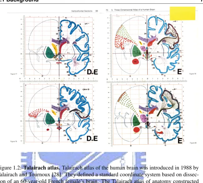Figure 1.2: Talairach atlas. Talairach atlas of the human brain was introduced in 1988 by Talairach and Tournoux [28]