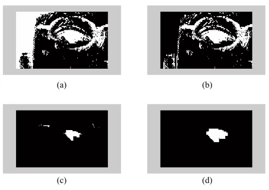 Fig. 3.5    Eye extraction from edge map of Fig. 3.3. (a) Edge map of eye region. (b)  Edge map with eliminating the hair region