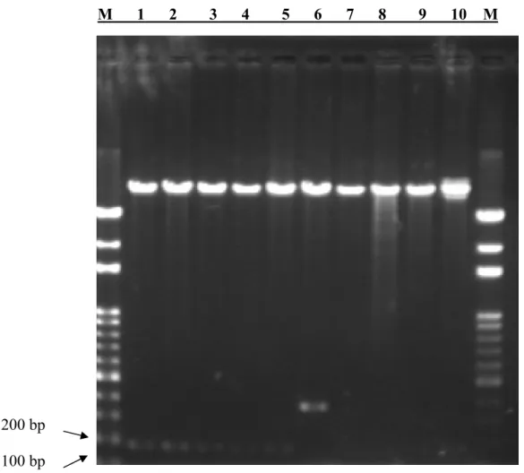 Figure 5. Restriction enzyme digestion of the pAAV-CEA-SARS construct. The plasmid  DNA was digested by XbaI and HindIII into a 174 bp fragment