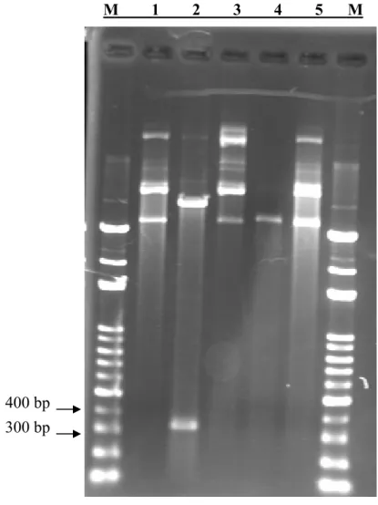 Figure 7. Restriction enzyme digestion of the pAAV-CEA-m2 construct. The plasmid was  digested by EcoRI and XhoIII into a 309 bp fragment